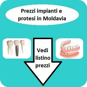 Prezzi impianti dentali e protesi in Moldavia, vedi listino prezzi